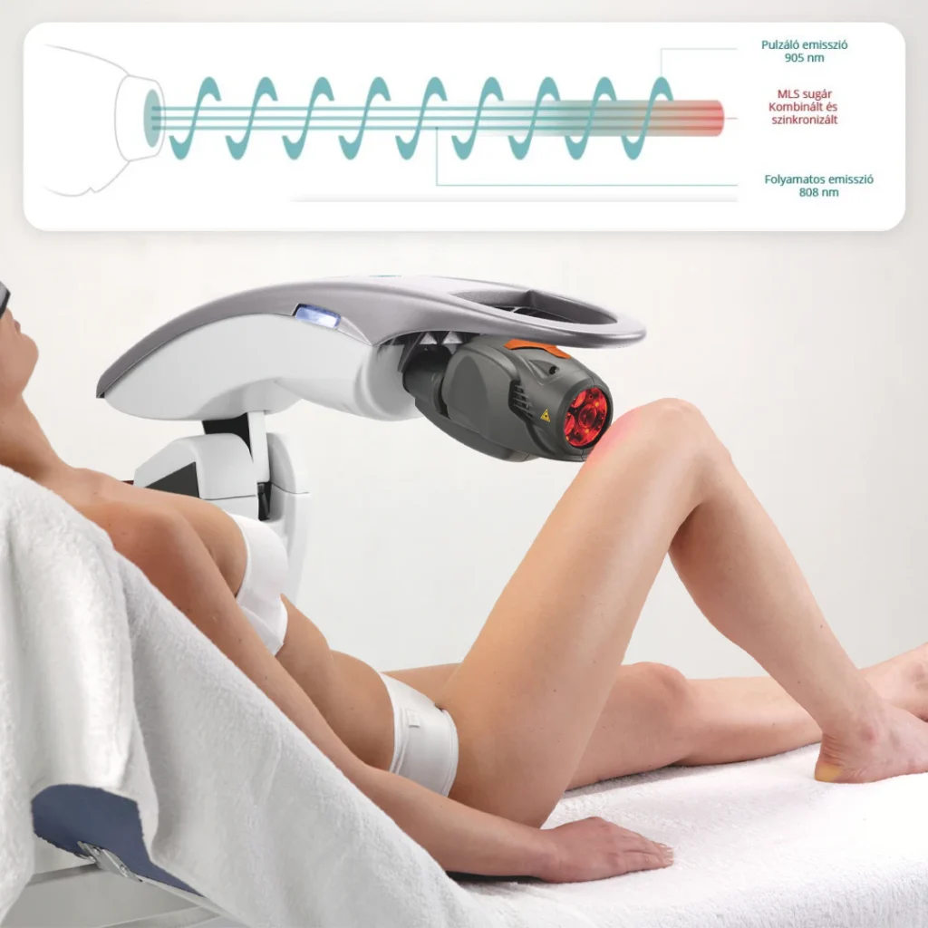Az MLS lézerterápia előnyei